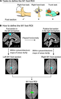 Hyper-Adaptation in the Human Brain: Functional and Structural Changes in the Foot Section of the Primary Motor Cortex in a Top Wheelchair Racing Paralympian